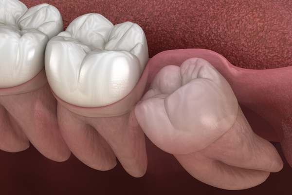 Emergency dental care